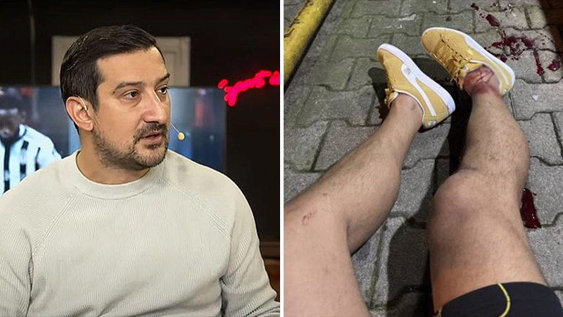 Ayağından vurulmuştu! Serhat Akın’dan 3 ay sonra paylaşım… Fenerbahçe‘nin eski futbolcusu Serhat Akın yılbaşında paylaşımda bulundu. Uğradığı saldırı