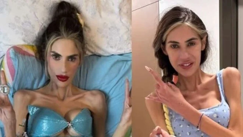 Nihal Candan hayatını kaybetti Anoreksiya nervoza rahatsızlığı nedeniyle 25 kilonun altına düşen sosyal medya