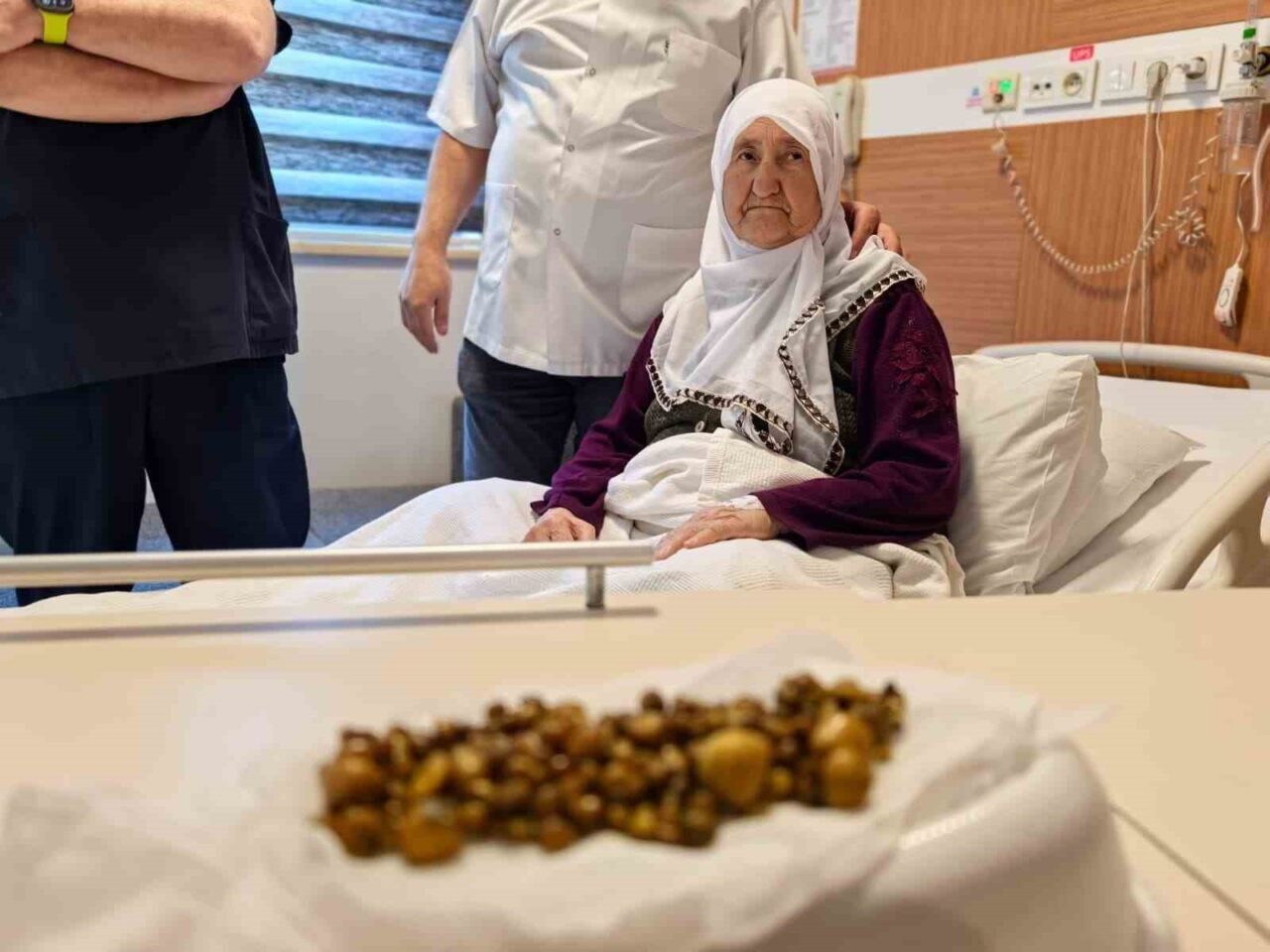 Bursa’nın İnegöl ilçesinde yaşayan 77 yaşındaki kadının safra kesesinden 213