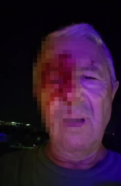 Darp edilen muhabir adeta kendi haline terk edildi Kocaeli’nin Karamürsel ilçesinde bir haber sırasında saldırıya uğrayan muhabir adeta