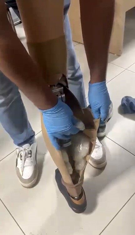 Protez bacağından uyuşturucu çıktı! 2 Bülten Medya -